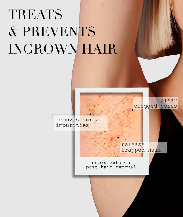 the Ingrown Bar the Ingrown Bar - Default Title in Skincare | Kaia Naturals