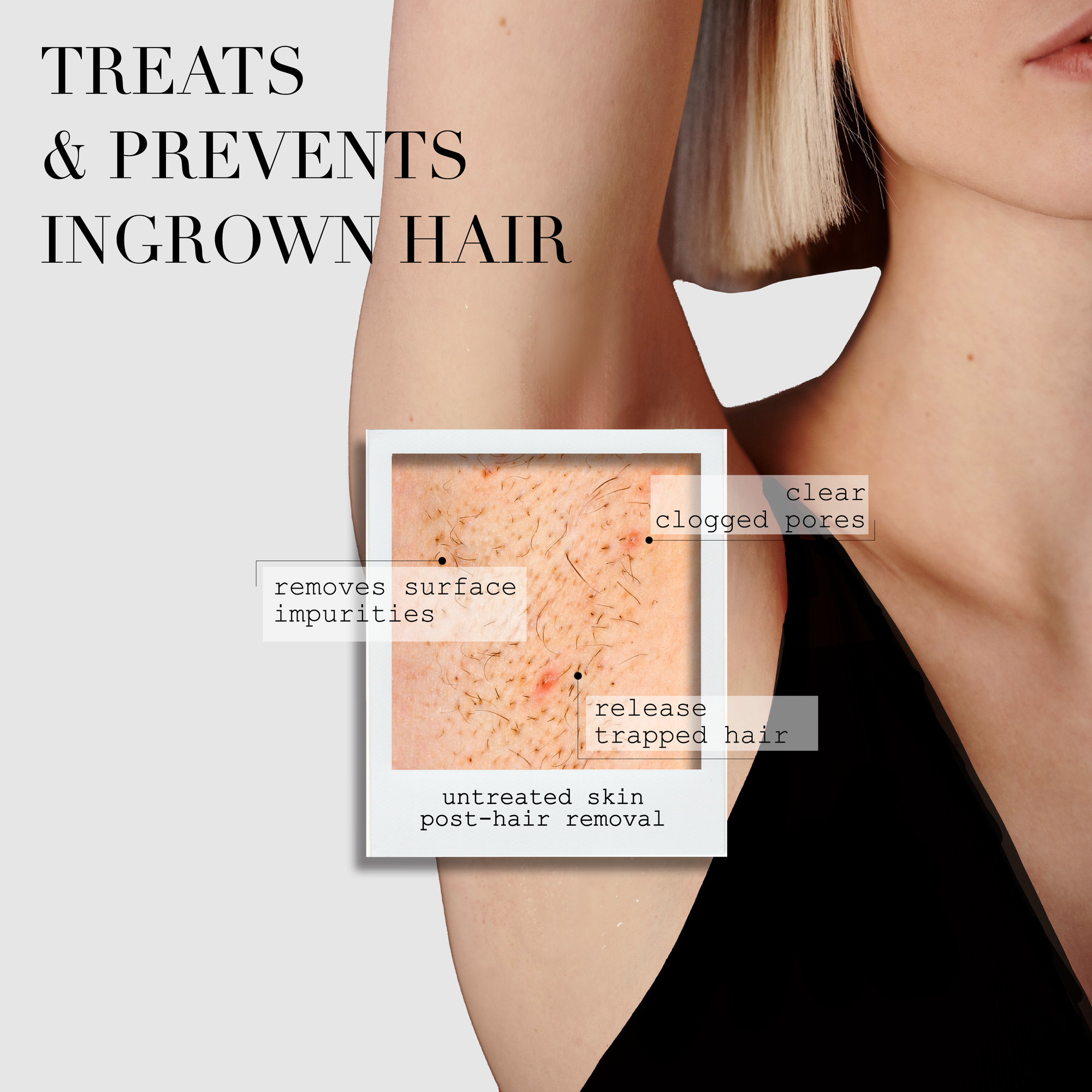 the Ingrown Bar the Ingrown Bar - Default Title in Skincare | Kaia Naturals